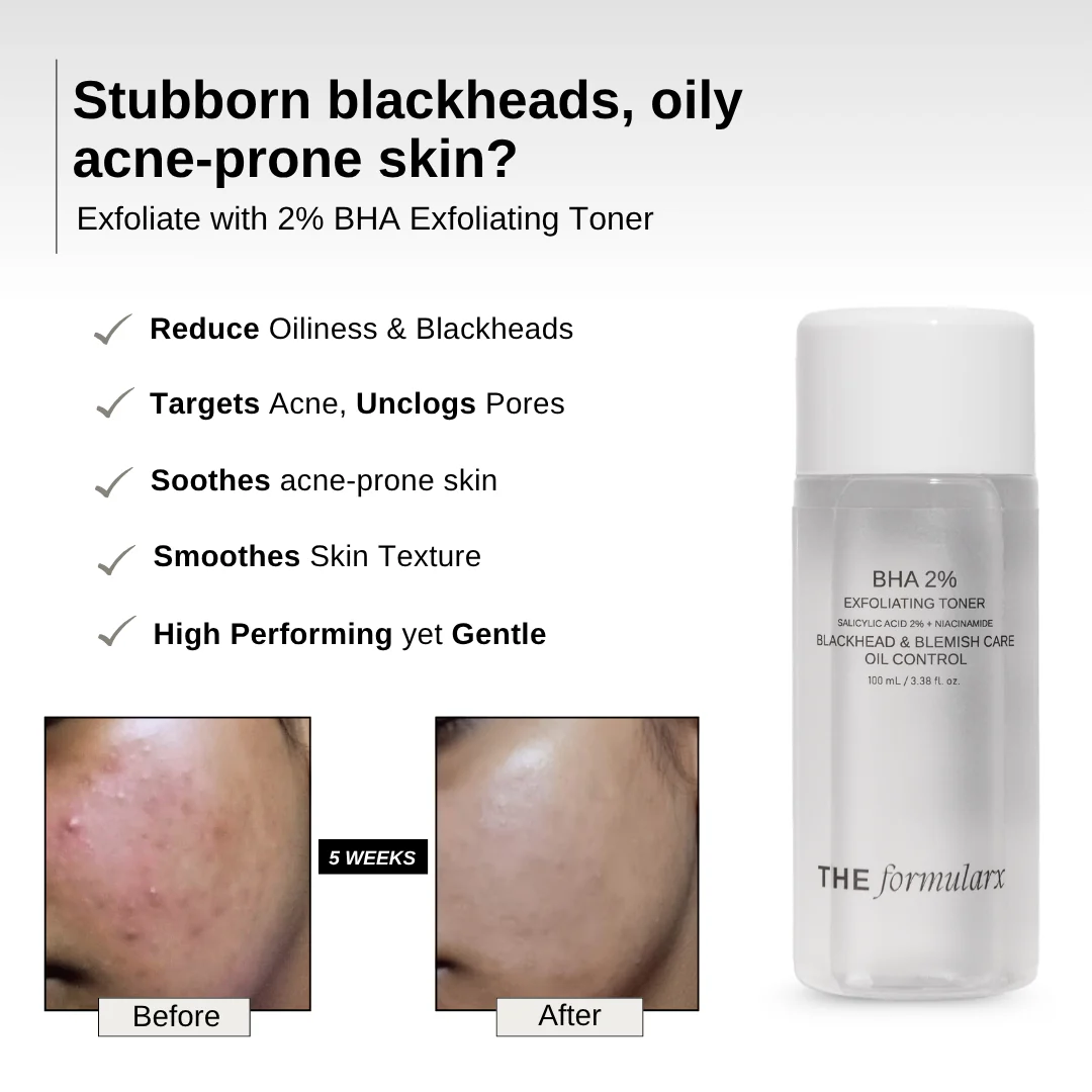 2% BHA Exfoliating Toner - Image 3