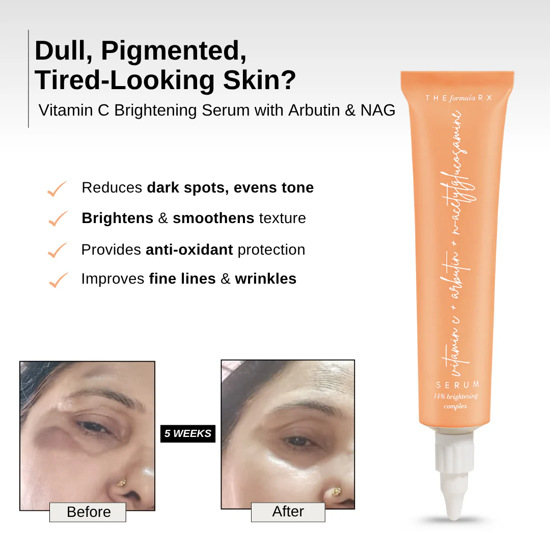 Vitamin C Brightening Serum with Arbutin & Nag - Image 4